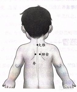 孩子感冒初期,家长学会这四招孩子马上就能好
